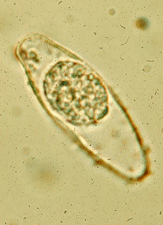 Oocyst of Isospora Belli