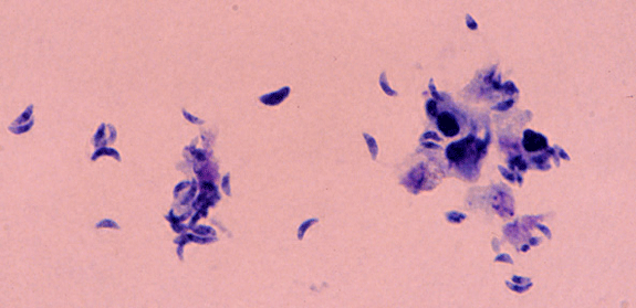 Toxoplasma gondii